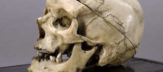 Cranio Brigante Villella 